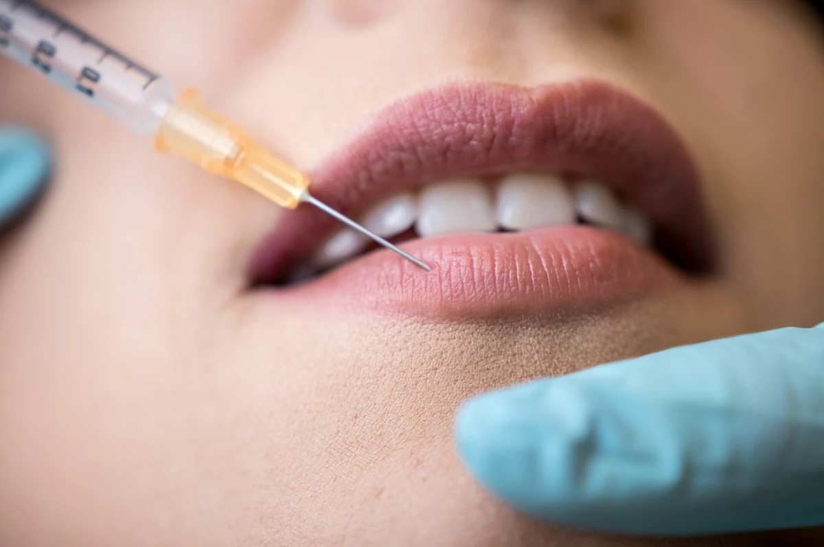 wstrzykiwanie preparatu w usta