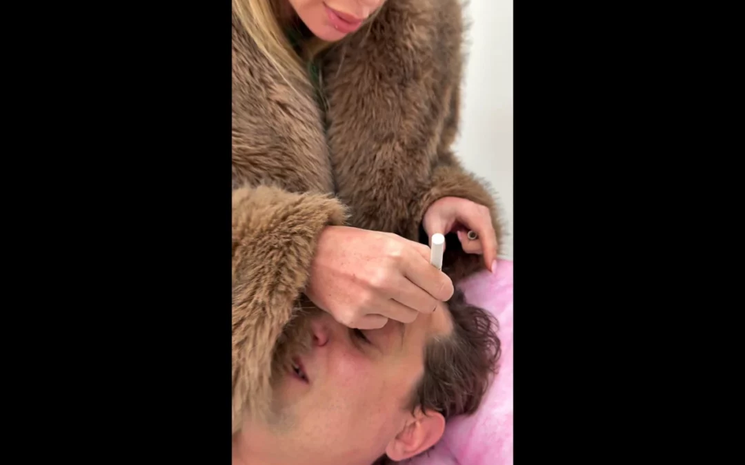 Konsultacje dermatologiczne :)