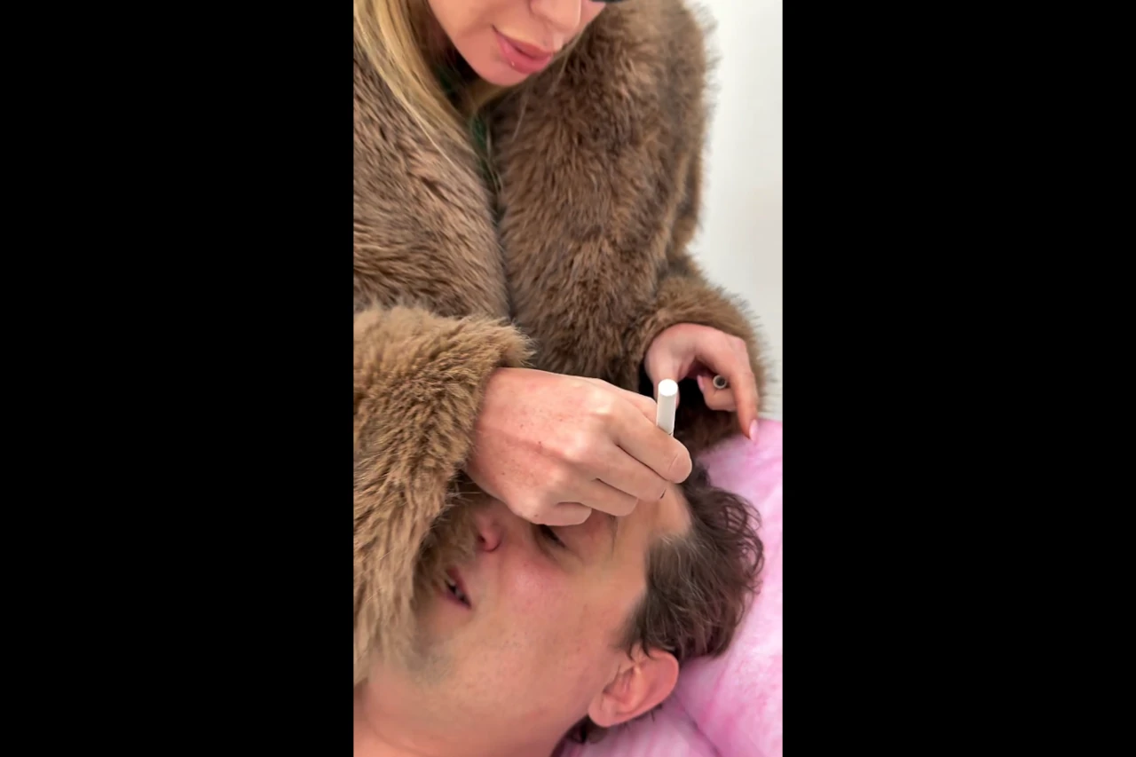 konsultacja dermatologiczna