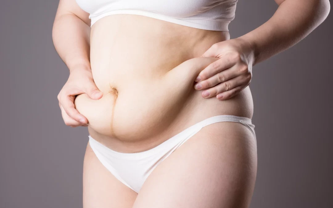 Plastyka brzucha w P & P Beauty Clinic